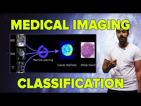 AI in Medicine |  Medical Imaging Classification (TensorFlow Tutorial)